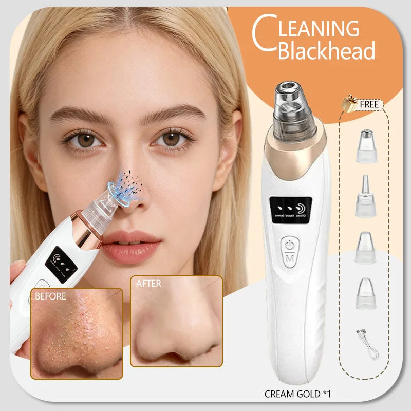 Blackhead and Blemish Removal Blackhead remover mask-pore vacuum-blackhead remover-nose blackhead remover- In StockFast Shipping