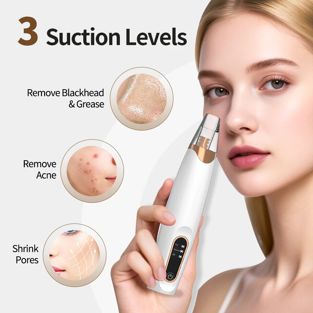 Electric Blackhead Vacuum Remover Vacuum Facial Pore Cleaner Acne Extractor Tool Nose Cleaner Blackhead Suction Tool Rechargeabl