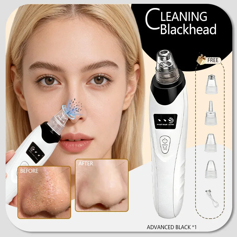 Blackhead and Blemish Removal Blackhead remover mask-pore vacuum-blackhead remover-nose blackhead remover- In StockFast Shipping