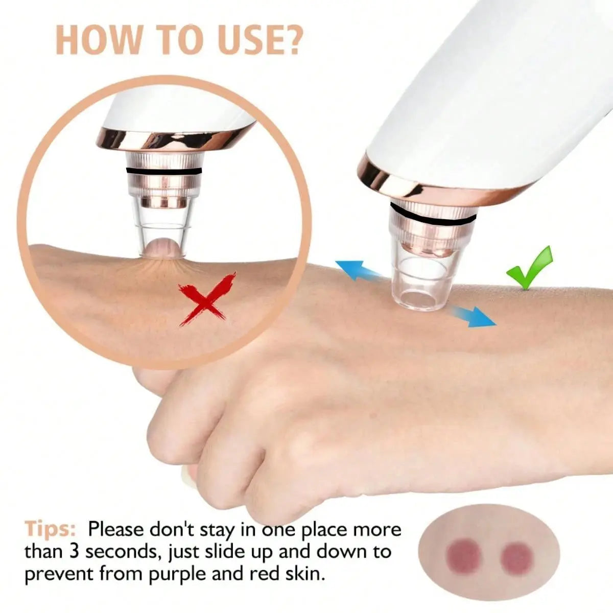 Portable Electric Blackhead Vacuum Remover Kit, Removes Blackheads & Whiteheads, Facial & Skin Care Device, 400mAh