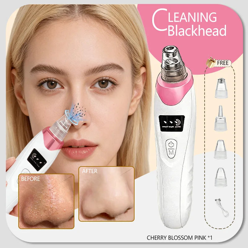 Blackhead and Blemish Removal Blackhead remover mask-pore vacuum-blackhead remover-nose blackhead remover- In StockFast Shipping