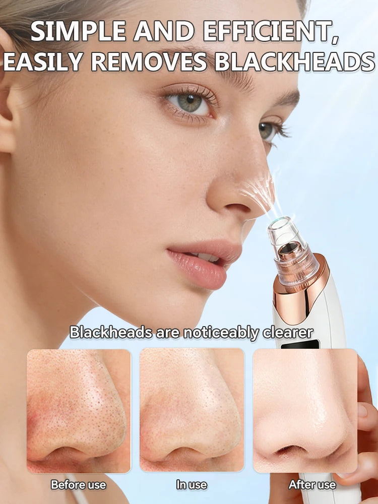 Blackhead and Blemish Removal Blackhead remover mask-pore vacuum-blackhead remover-nose blackhead remover- In StockFast Shipping