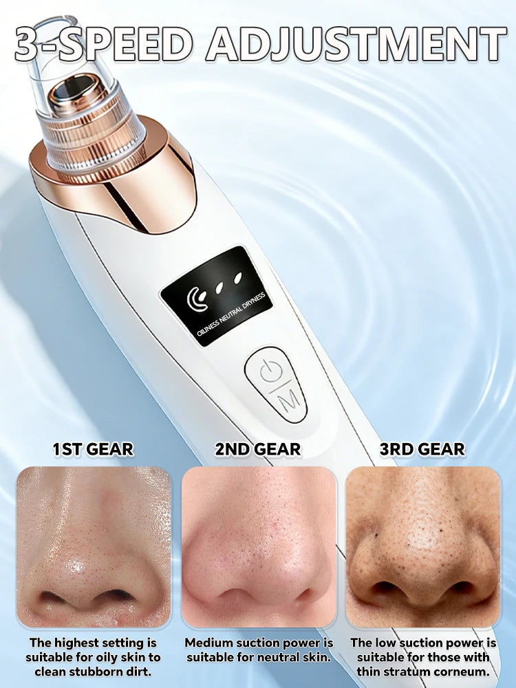 Blackhead and Blemish Removal Blackhead remover mask-pore vacuum-blackhead remover-nose blackhead remover- In StockFast Shipping